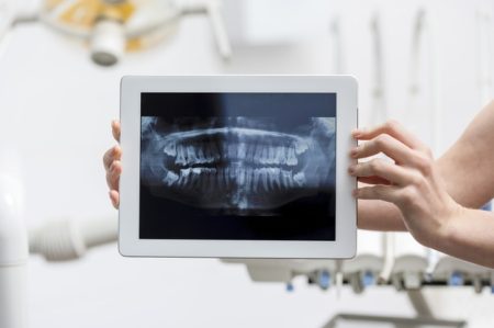 RadiografiaOraliPad
